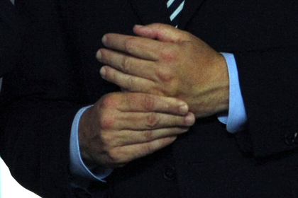 Москвичу отрубило палец обручальным кольцом