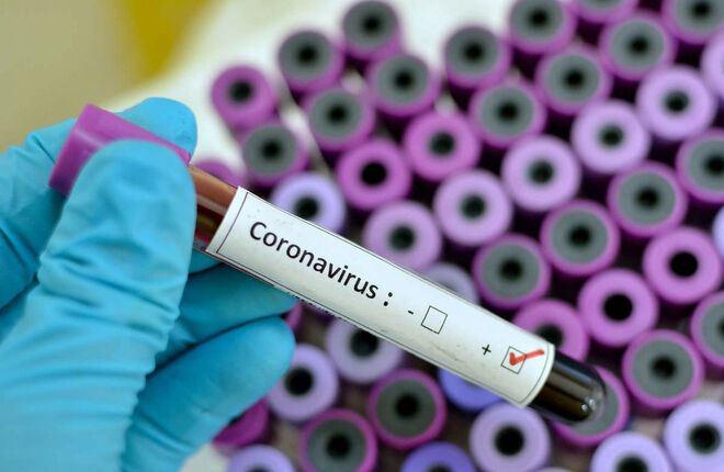 Еще пять человек заболели коронавирусом во Франции