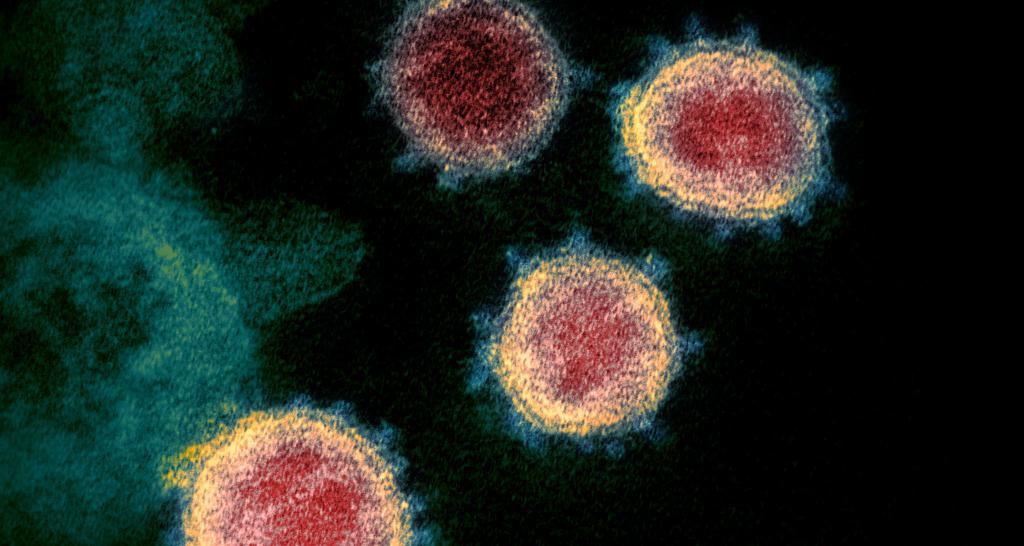 Швейцарцы хотят начать вакцинацию от коронавируса уже в октябре