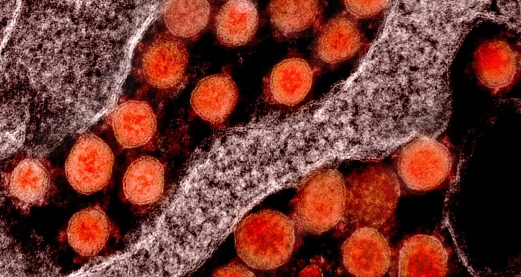 Обнаружены антитела с высокой эффективностью против коронавируса