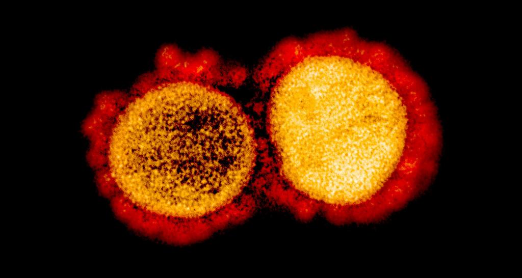 В организме детей  SARS-CoV-2 и антитела к нему могут соседствовать