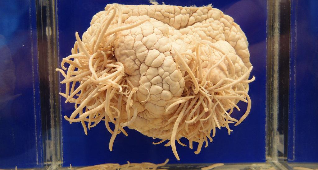 Пожиратель мозга: паразит, питающийся мозгом человека