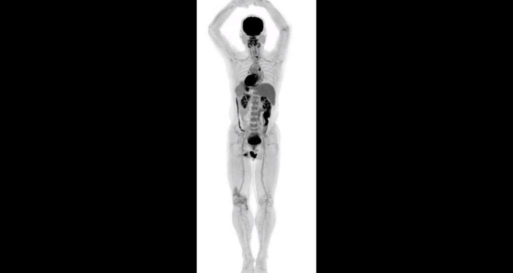 Уникальные фотографии, сделанные первым в мире сканером для тела