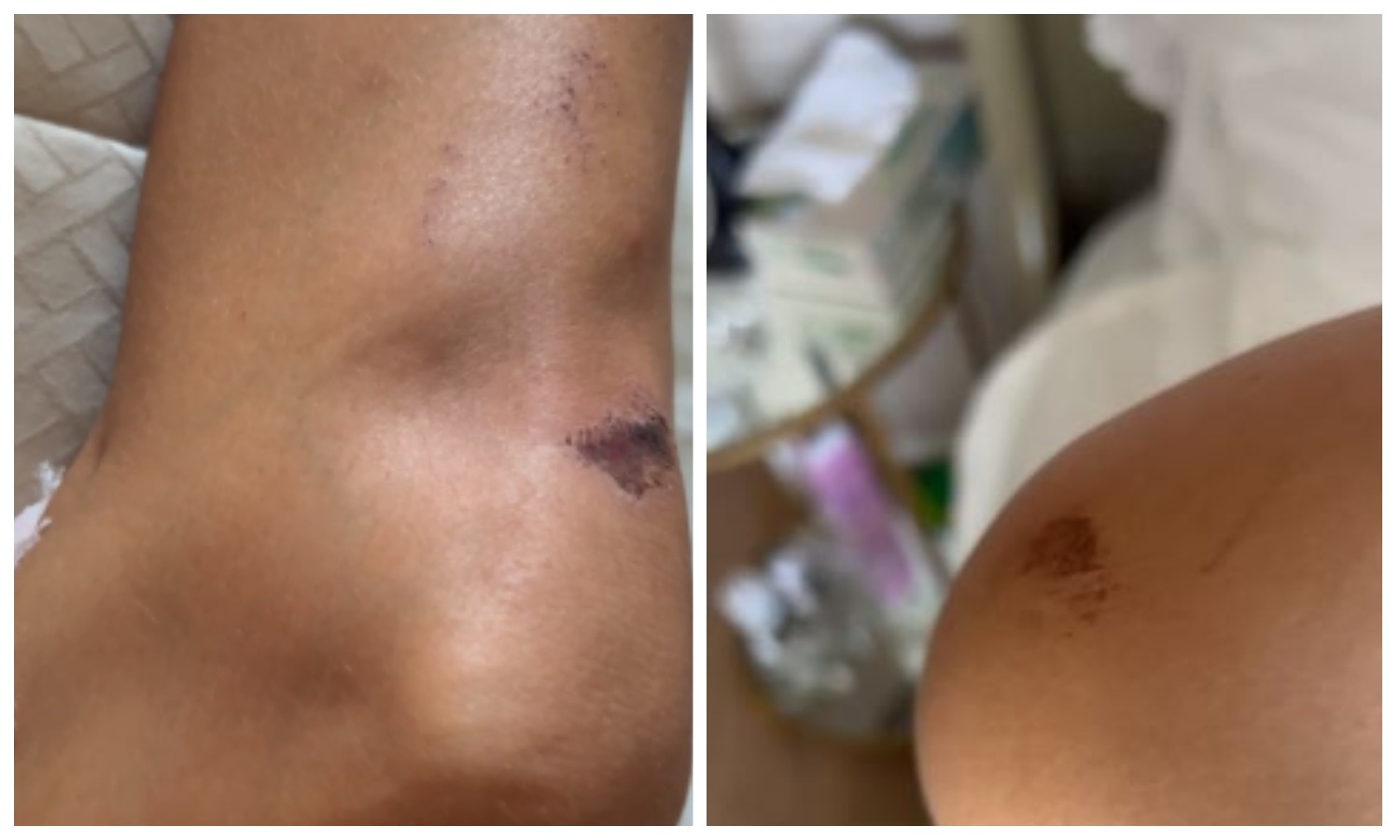 Боня упала с лошади в горном ущелье и травмировалась