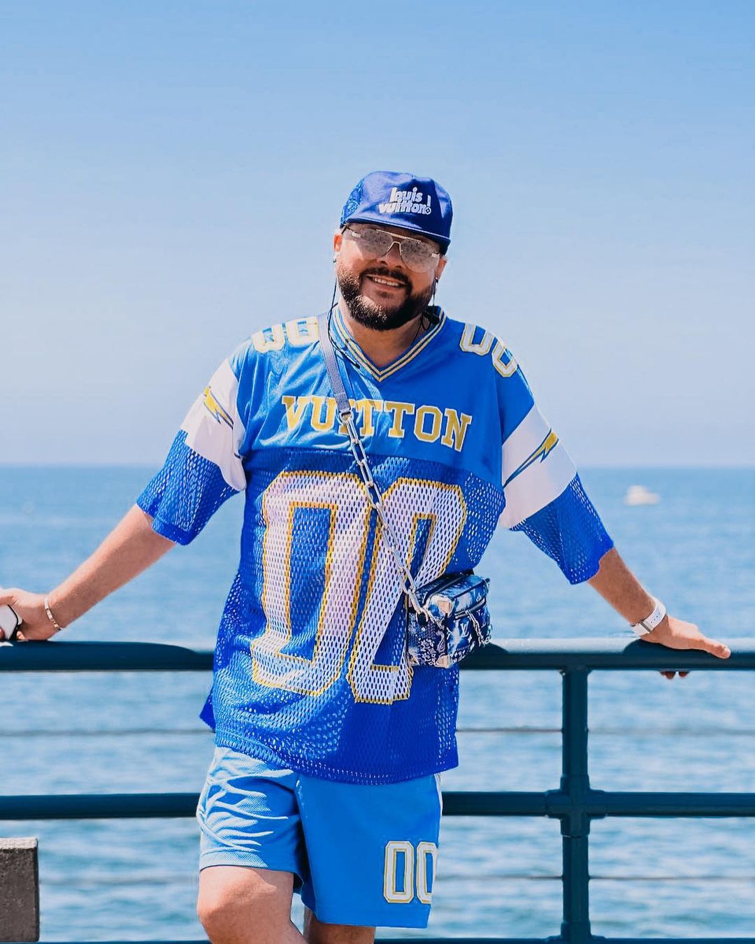 Киркоров сделал пластическую операцию