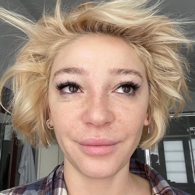 Как быстро избавиться от утренних отеков