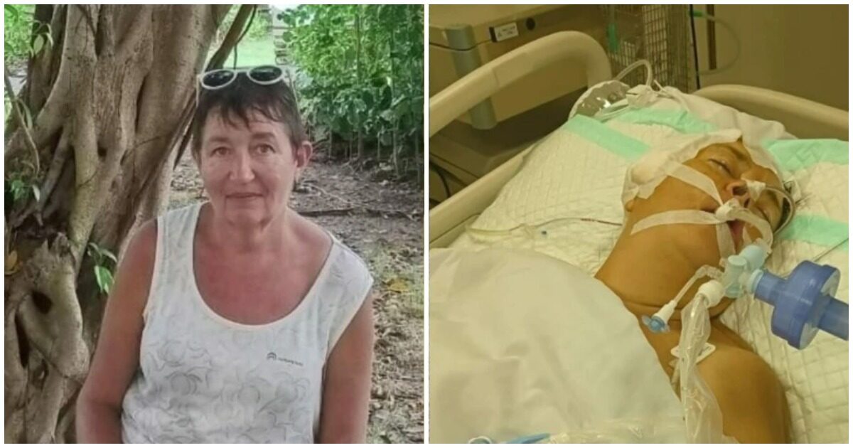 Россиянка без страховки впала в кому на Бали