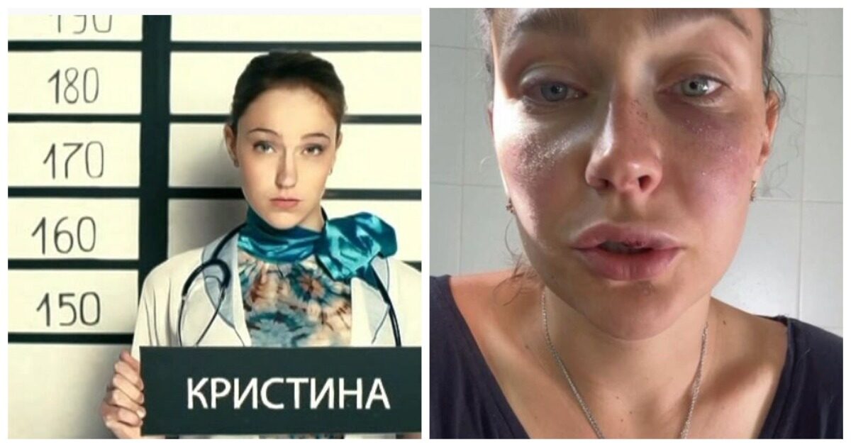 Актрису сериала «Интерны» избили в ее день рождения
