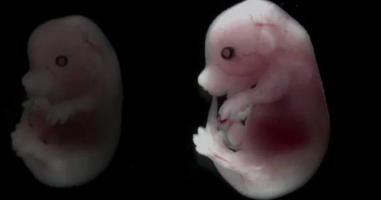 Врачи впервые провели трансплантацию органов эмбриону в утробе