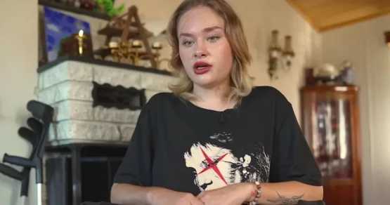 Модель Мария Ковальчук показала, какой была после избиения в Дубае