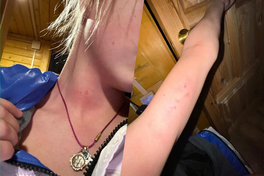 Яна Рудковская показала видео, где мать избивает фигуристку Костылеву