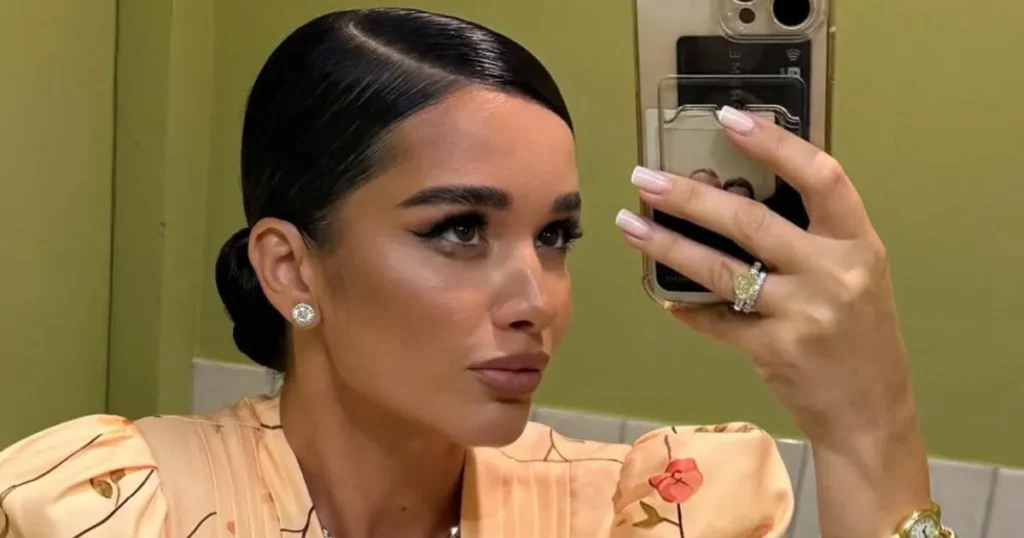 Бородина рассказала про фингал под глазом перед Новым годом