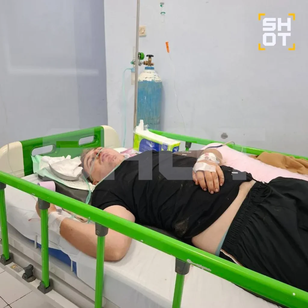 Россиянин попал в страшное ДТП на Бали