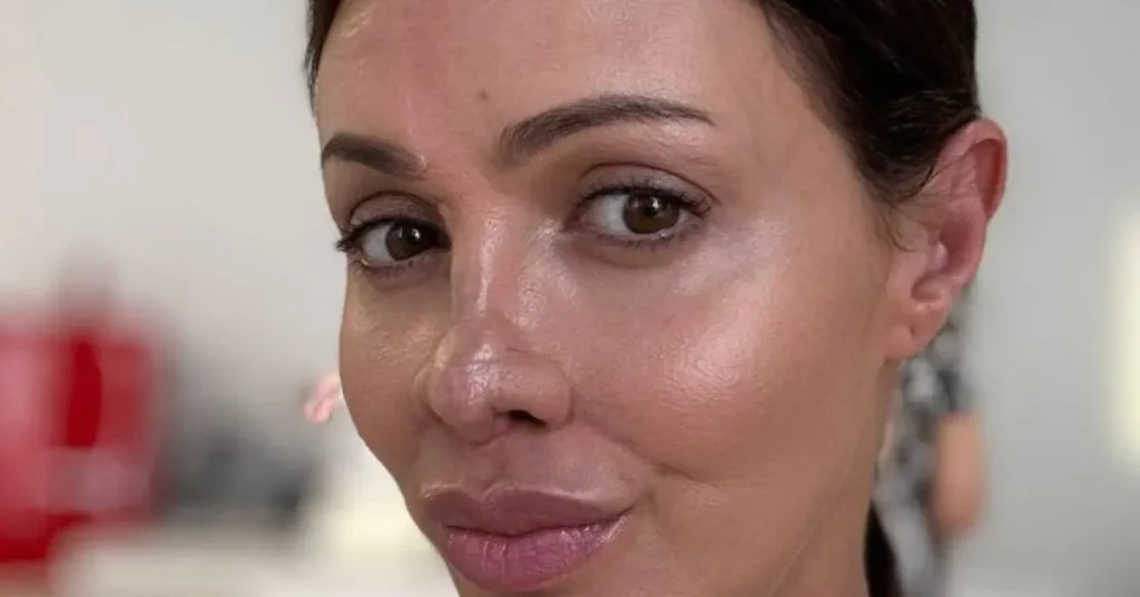 Экс-супруга Аршавина раскрыла детали заболевания, из-за которого лишилась носа