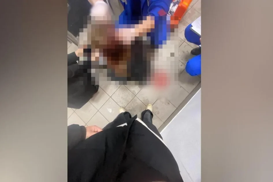 Появились подробности о состоянии московской школьницы после удара током Появились подробности о состоянии московской школьницы после удара током