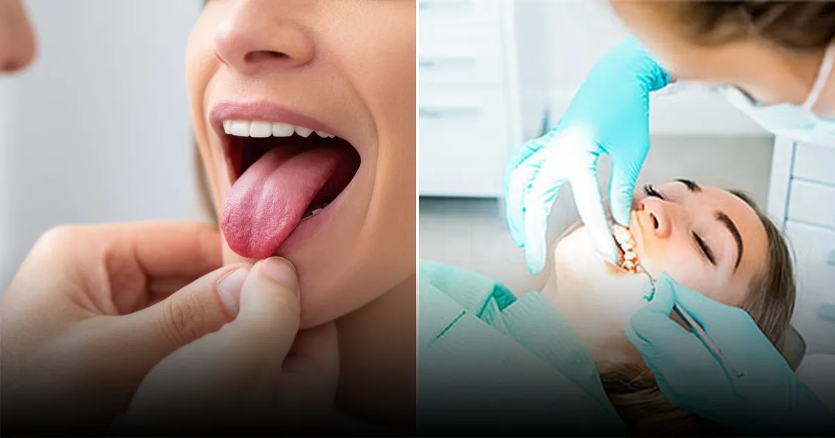 Названы системные заболевания, которые может выявить стоматолог