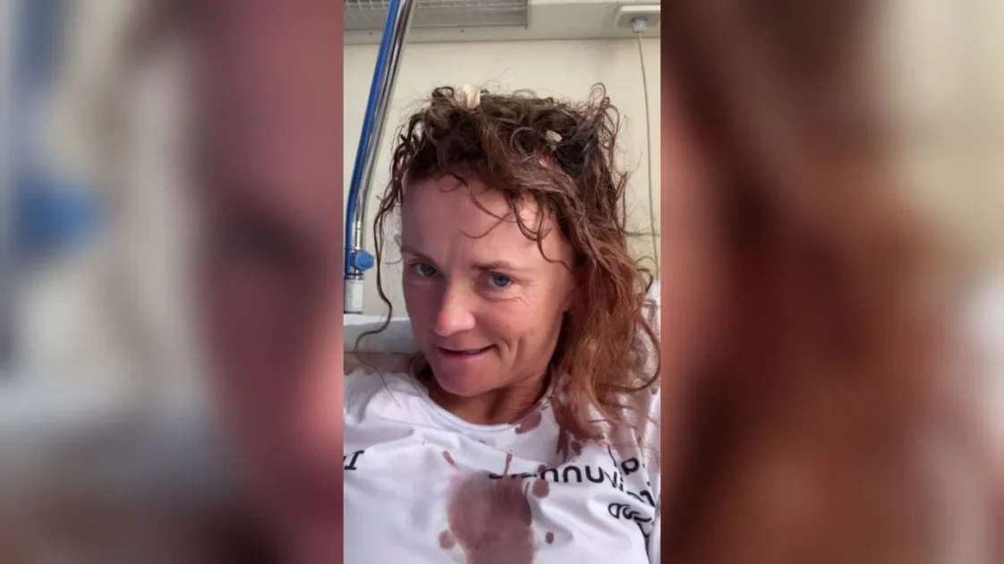 Стая собак на Кипре напала на легкоатлетку Масанову Стая собак на Кипре напала на легкоатлетку Масанову