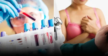 Почему важно проходить онкологический чекап: какие анализы сдавать в 25, 40 и 65 лет