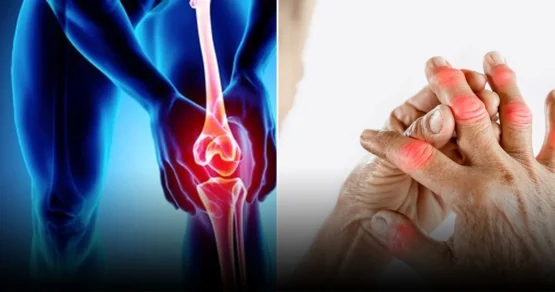 Учёные разработали препарат, навсегда избавляющий от боли в суставах