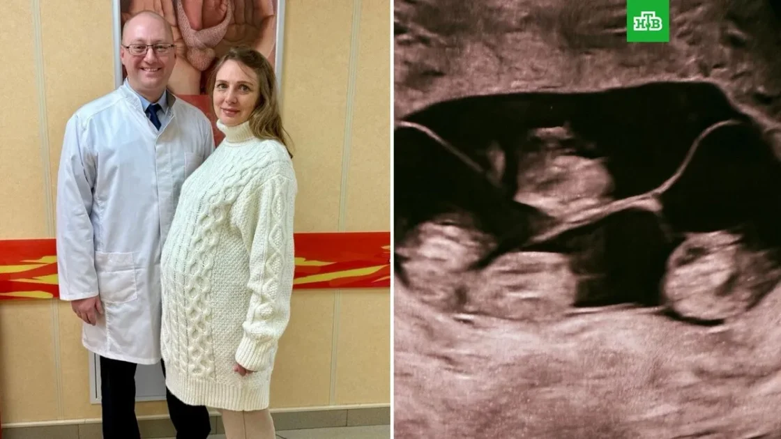 В Петербурге родились однояйцевые четверняшки В Петербурге родились однояйцевые четверняшки