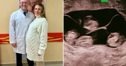 В Петербурге родились однояйцевые четверняшки